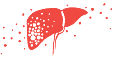 An illustration of a person's liver.