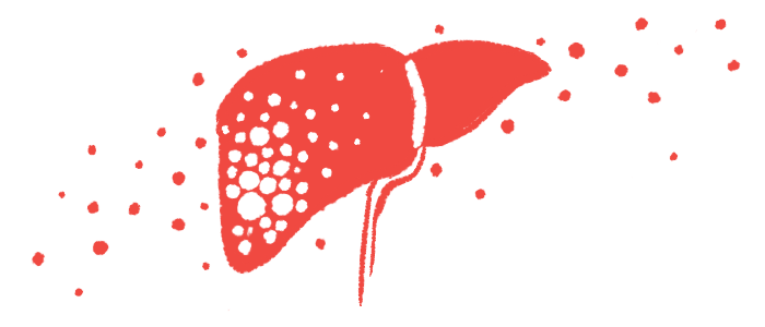 An illustration of a person's liver.