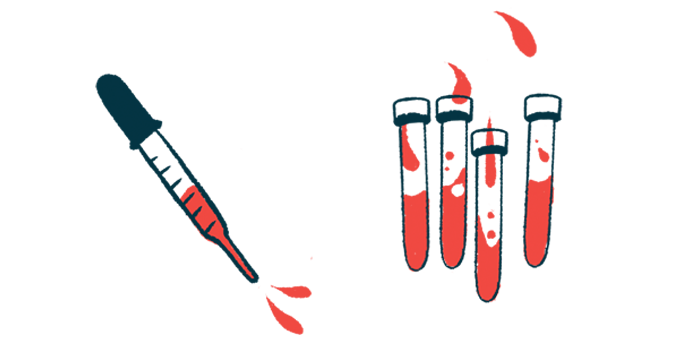 A dropper hovers next to three vials of blood.