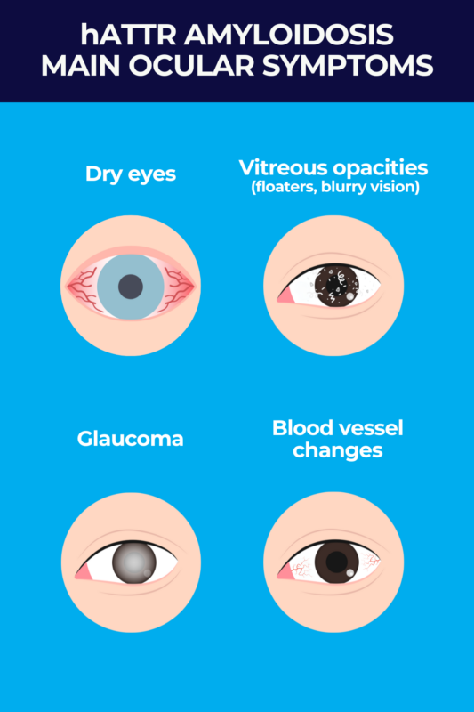 Eyes infographic