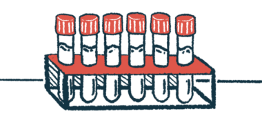 A selection of test tubes are shown resting in a test tube holder.