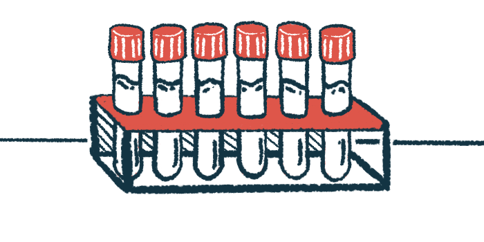 A selection of test tubes are shown resting in a test tube holder.
